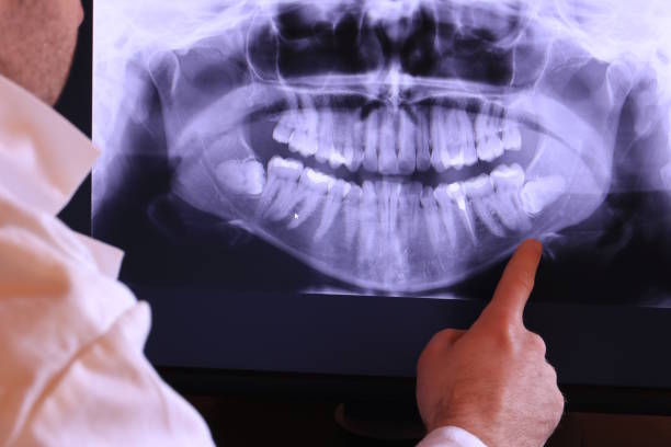 Best Orthodontic Emergency Dentist in Concord, MI