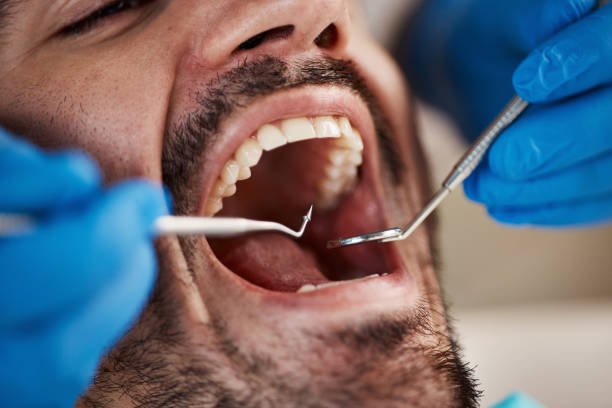 Best Mobile Emergency Dentist in Concord, MI